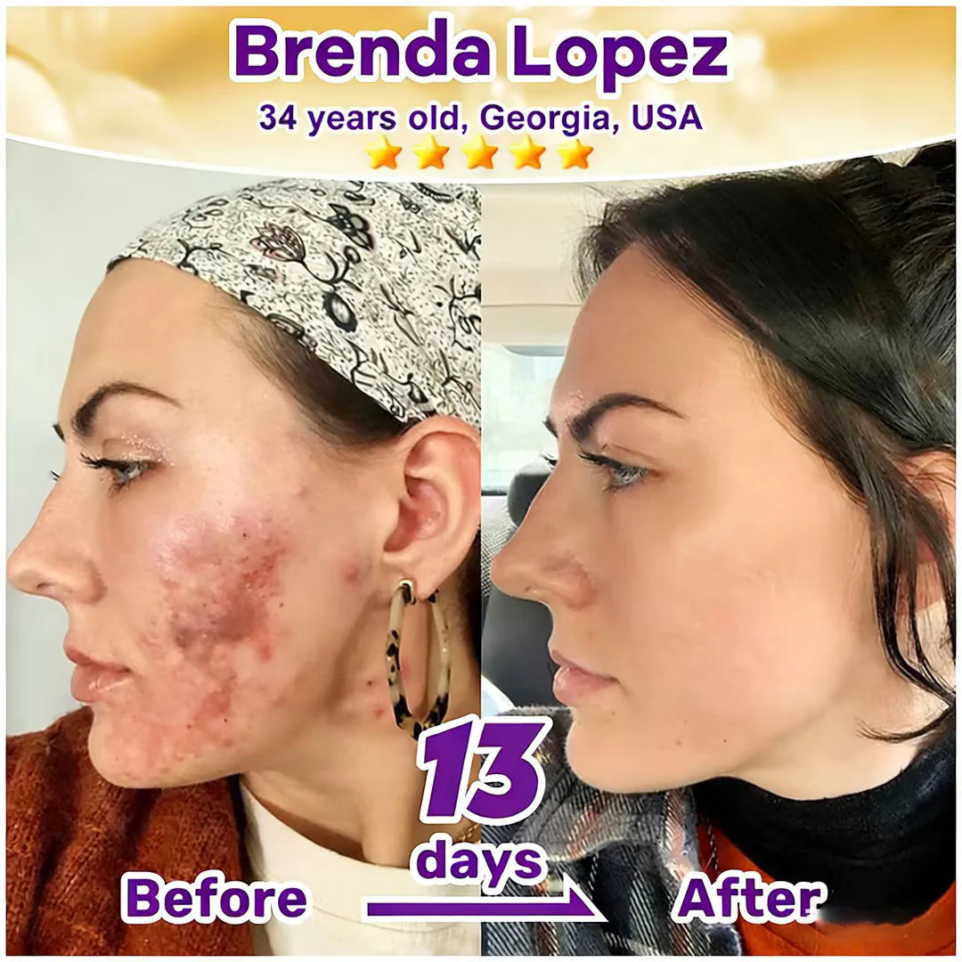 KLENIMORE® Biotin 10-in-1 Skin Restoration Cream