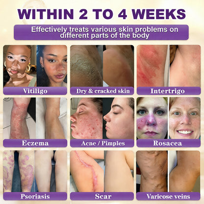 KLENIMORE® Biotin 10-in-1 Skin Restoration Cream