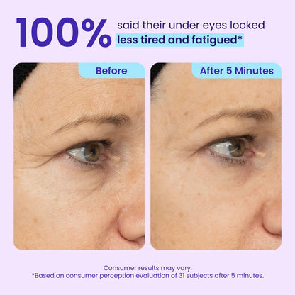 Final 3 Hours: 50%OFF🔥 Instant Lift Eye Gel for Puffiness, Bags & Dark Circles