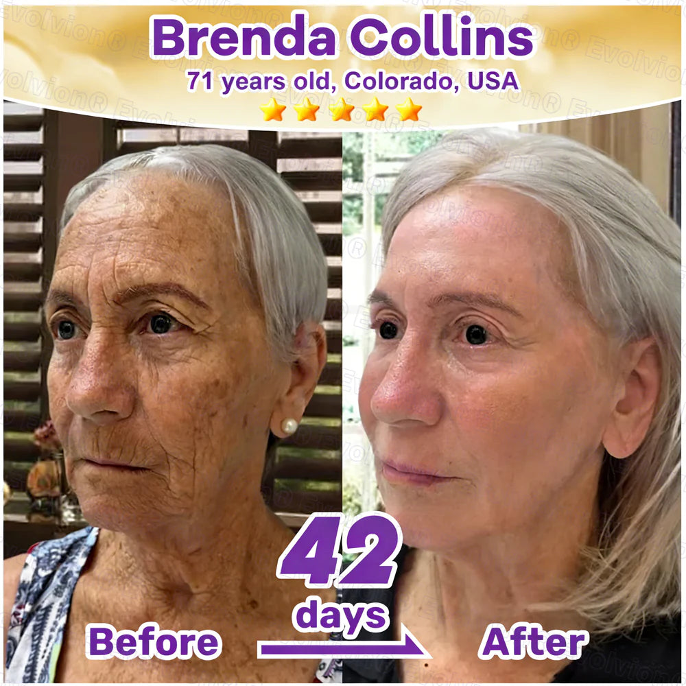 KLENIMORE® Biotin 10-in-1 Skin Restoration Cream
