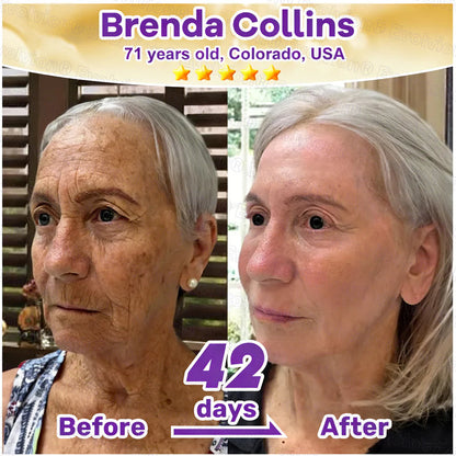 KLENIMORE® Biotin 10-in-1 Skin Restoration Cream