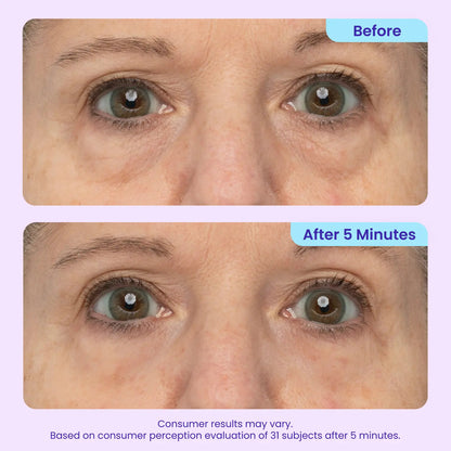 Final 3 Hours: 50%OFF🔥 Instant Lift Eye Gel for Puffiness, Bags & Dark Circles