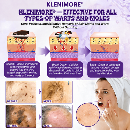 KLENIMORE® Biotin 10-in-1 Skin Restoration Cream