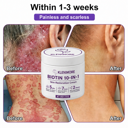 KLENIMORE® Biotin 10-in-1 Skin Restoration Cream
