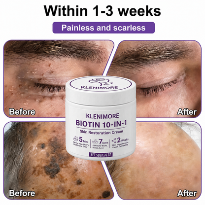KLENIMORE® Biotin 10-in-1 Skin Restoration Cream