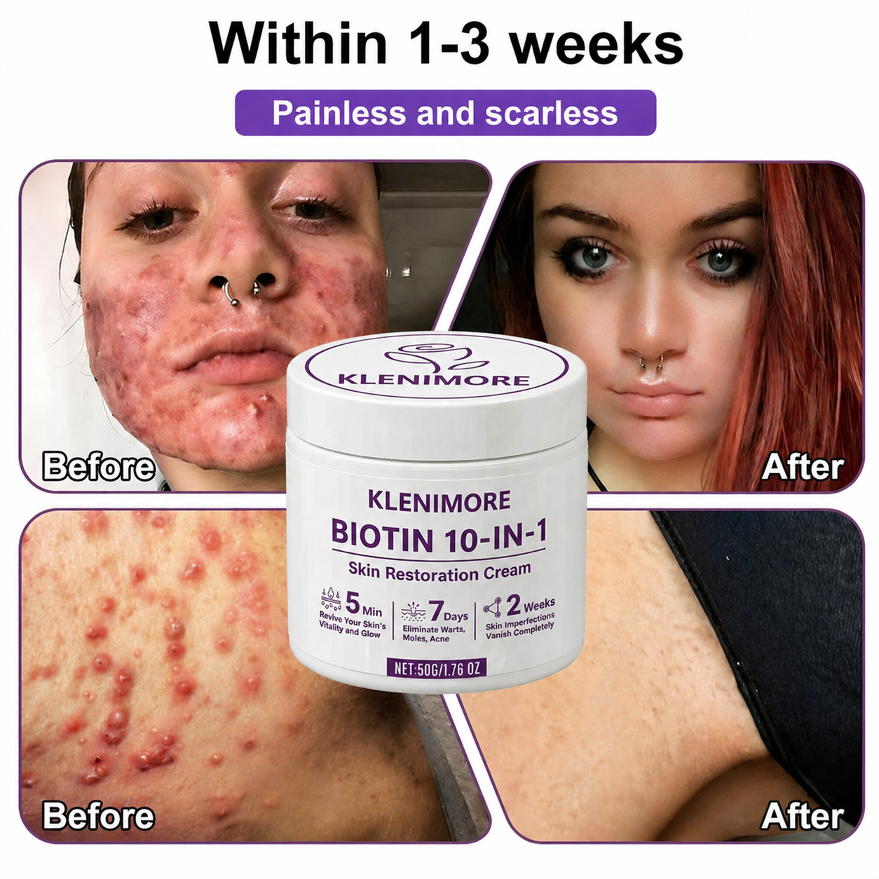 KLENIMORE® Biotin 10-in-1 Skin Restoration Cream