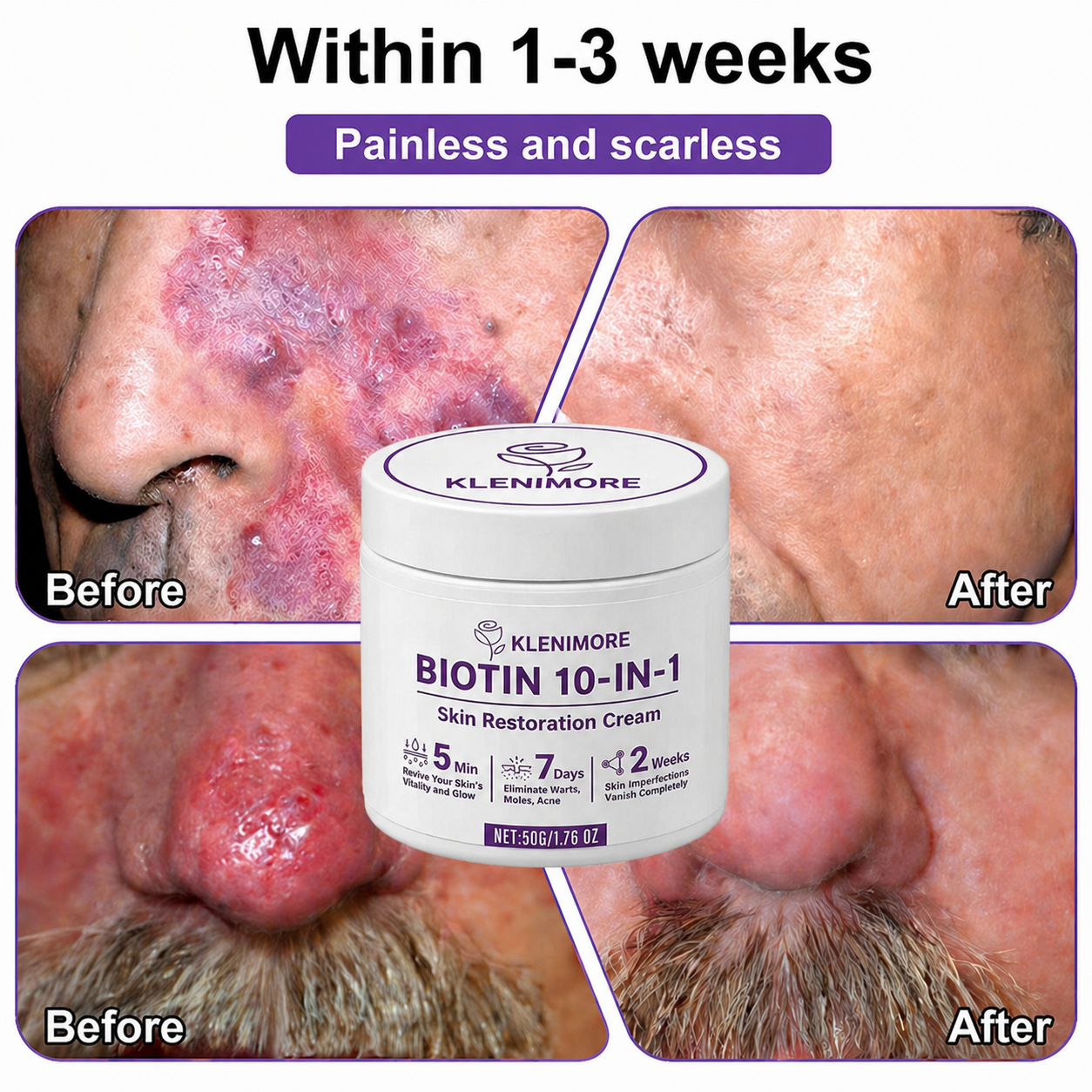 KLENIMORE® Biotin 10-in-1 Skin Restoration Cream