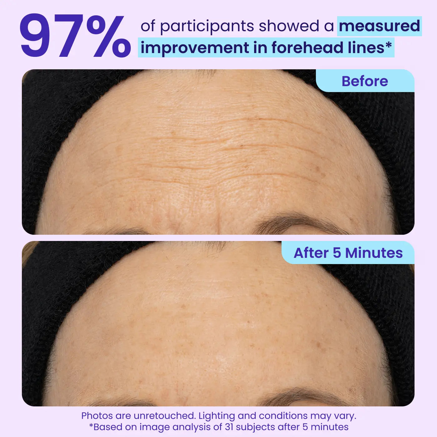 Final 3 Hours: 50%OFF🔥 Instant Lift Eye Gel for Puffiness, Bags & Dark Circles