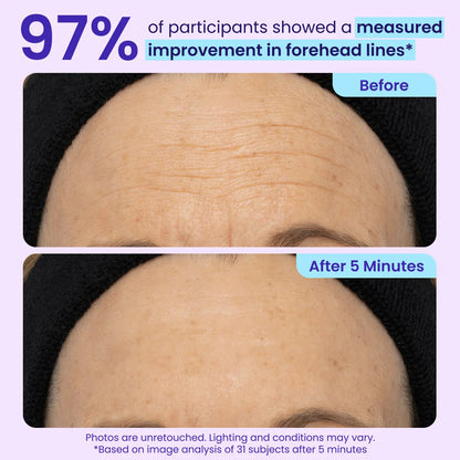 Final 3 Hours: 50%OFF🔥 Instant Lift Eye Gel for Puffiness, Bags & Dark Circles